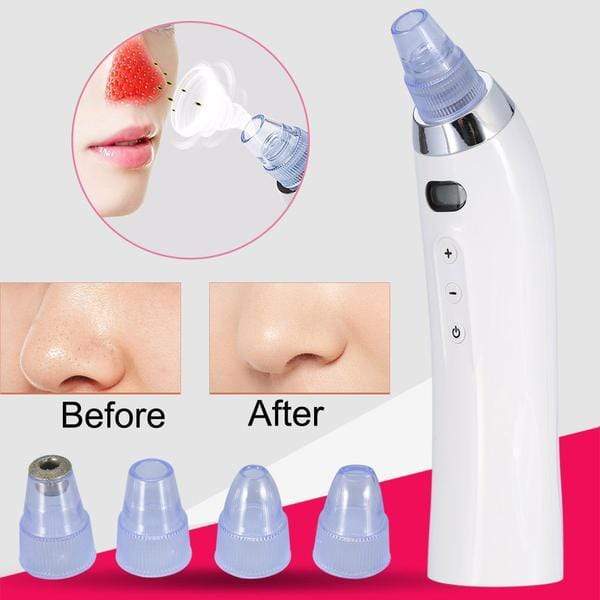 Need Vanity™ - Professional Facial Pore Vacuum