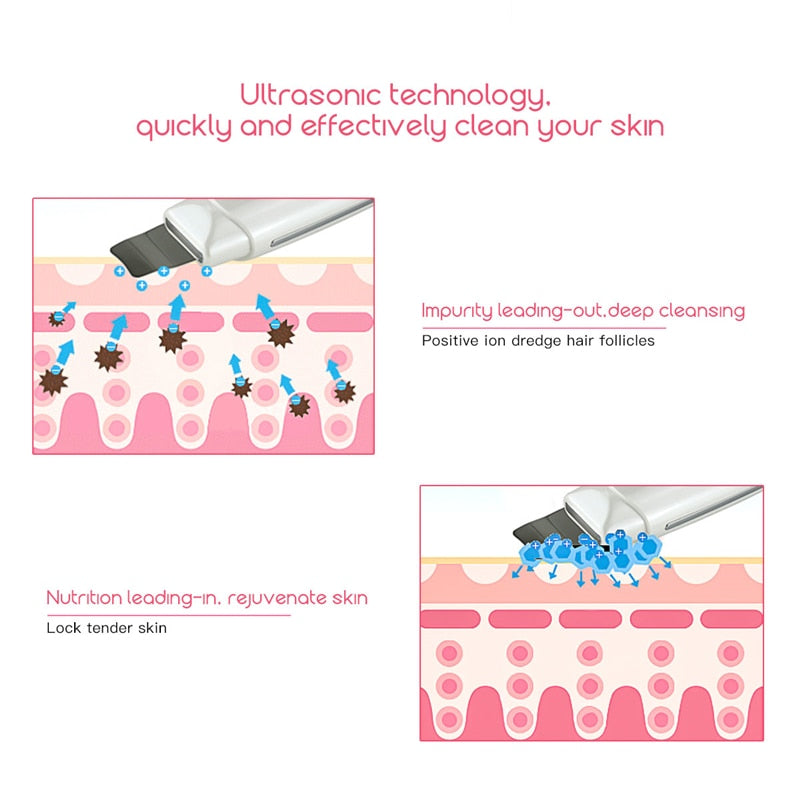 Need Vanity™ - Ultrasonic Skin Scrubber