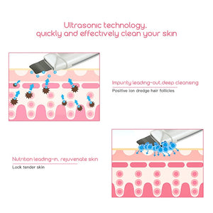 Need Vanity™ - Ultrasonic Skin Scrubber